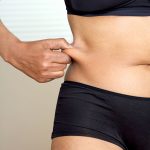 Liposuction or Tummy Tuck? All the Information You Need