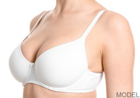 Breast Augmentation