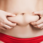 Timing Guidelines for Plastic Surgery After Weight Loss